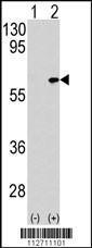 Anti-TAB1 Rabbit Polyclonal Antibody (APC (Allophycocyanin))