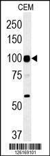 Anti-ATP6V0A4 Rabbit Polyclonal Antibody (APC (Allophycocyanin))