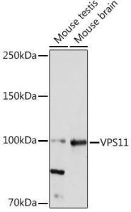 Western blot analysis of extracts of various cell lines, using Anti-VPS11 Antibody [ARC2325] (A306832) at 1:1,000 dilution