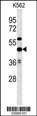 Anti-UBAC1 Rabbit Polyclonal Antibody