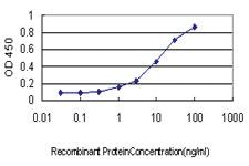 Anti-SERPINI1 Mouse Monoclonal Antibody [clone: 1D10]