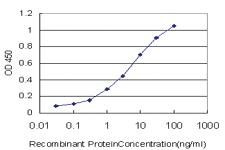 Anti-ACAP2 Mouse Monoclonal Antibody [clone: 4G3]