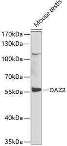 Western blot analysis of extracts of mouse testis, using Anti-DAZ2 Antibody (A12146) at 1:1,000 dilution. The secondary antibody was Goat Anti-Rabbit IgG H&L Antibody (HRP) at 1:10,000 dilution.