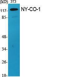 Anti-SDCG1 antibody