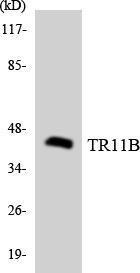 Western blot analysis of the lysates from HeLa cells using Anti-TR11B Antibody