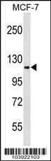 Anti-HK1 Rabbit Polyclonal Antibody