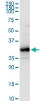 Anti-HADH Rabbit Polyclonal Antibody