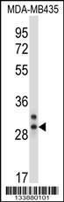 Anti-CELA2A Rabbit Polyclonal Antibody (Biotin)