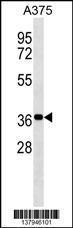 Anti-NSMCE1 Rabbit Polyclonal Antibody (FITC (Fluorescein Isothiocyanate))