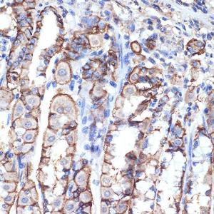 Immunohistochemistry analysis of paraffin-embedded mouse stomach using Anti-VPS11 Antibody [ARC2325] (A306832) at a dilution of 1:100 (40X lens). Perform microwave antigen retrieval with 10 mM Tris/EDTA buffer pH 9.0 before commencing with IHC staining protocol