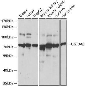 Western blot analysis of extracts of various cell lines, using Anti-UGT3A2 Antibody (A12147) at 1:1000 dilution. The secondary Antibody was Goat Anti-Rabbit IgG H&L Antibody (HRP) at 1:10000 dilution. Lysates/proteins were present at 25 µg per lane