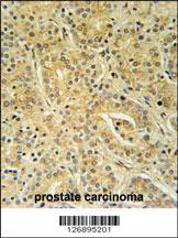 Anti-UBAC1 Rabbit Polyclonal Antibody