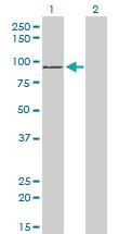 Anti-ZNF281 Mouse Monoclonal Antibody [clone: 4F7]