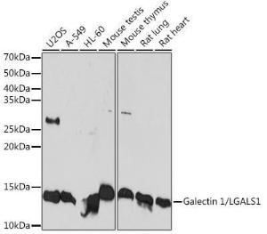 Anti-Galectin 1 Rabbit Monoclonal Antibody [clone: ARC1110]