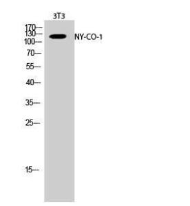 Anti-SDCG1 antibody