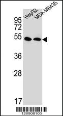 Anti-SLC47A1 Rabbit Polyclonal Antibody