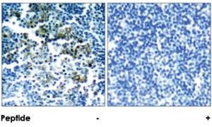 Anti-BCR Rabbit Polyclonal Antibody