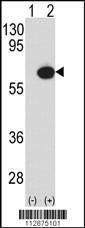 Anti-TAB1 Rabbit Polyclonal Antibody (AP (Alkaline Phosphatase))