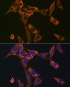 Anti-Galectin 1 Rabbit Monoclonal Antibody [clone: ARC1110]