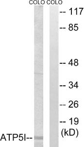 Western blot analysis of lysates from COLO cells using Anti-ATP5I Antibody. The right hand lane represents a negative control, where the antibody is blocked by the immunising peptide