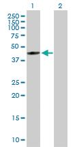 Anti-FDFT1 Mouse Polyclonal Antibody