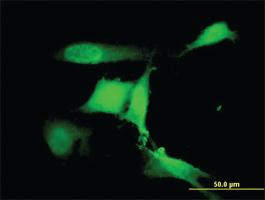 Anti-RFWD2 Mouse Monoclonal Antibody [clone: 1E4]