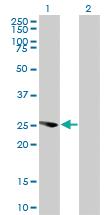 Anti-EXOSC4 Mouse Monoclonal Antibody [clone: 4F10]