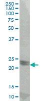 Anti-ATF3 Mouse Monoclonal Antibody [clone: 8D8]