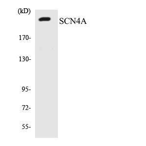 Western blot analysis of the lysates from COLO205 cells using Anti-SCN4A Antibody