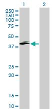 Anti-SERPINI2 Mouse Polyclonal Antibody