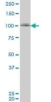 Anti-ZNF281 Mouse Monoclonal Antibody [clone: 1C9]