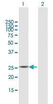 Anti-PYCRL Mouse Polyclonal Antibody