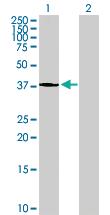 Anti-ATP6V1C2 Mouse Polyclonal Antibody