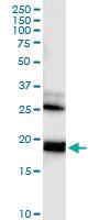 Anti-RHEB Polyclonal Antibody Pair