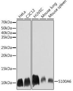 Western blot analysis of extracts of various cell lines, using Anti-S100 alpha 6/PRA Antibody [ARC2005] (A306836) at 1:1,000 dilution