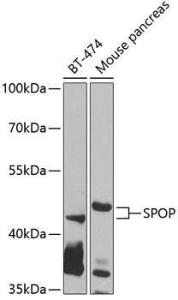 Western blot analysis of extracts of various cell lines, using Anti-SPOP Antibody (A12151) at 1:1,000 dilution The secondary antibody was Goat Anti-Rabbit IgG H&L Antibody (HRP) at 1:10,000 dilution Lysates/proteins were present at 25 µg per lane