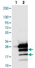 Anti-PPP1R14D Rabbit Polyclonal Antibody