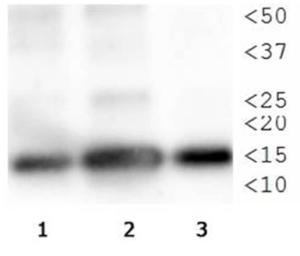 Anti-NF1 Mouse Monoclonal Antibody [clone: McNFn27b]