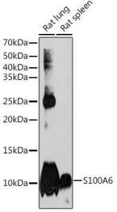 Western blot analysis of extracts of various cell lines, using Anti-S100 alpha 6/PRA Antibody [ARC2005] (A306836) at 1:1,000 dilution