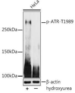 Western blot analysis of extracts of HeLa cells, using Anti-ATR (phospho Thr1989) Antibody (A308032) at 1:1000 dilution. HeLa cells were treated by Hydroxyurea (4 mM) at 37°C for 20 hours. The secondary Antibody was Goat Anti-Rabbit IgG H&L Antibody (HRP) at 1:10000 dilution