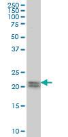 Anti-ATF3 Mouse Monoclonal Antibody [clone: 8G5]