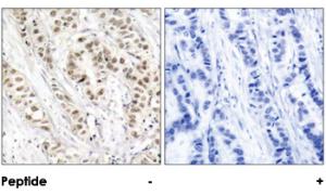 Anti-BRCA1 Rabbit Polyclonal Antibody