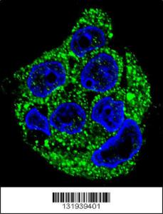 Anti-PPP4R1L Rabbit Polyclonal Antibody (Biotin)