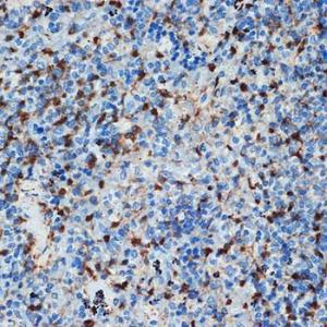 Immunohistochemistry analysis of paraffin-embedded rat spleen using Anti-S100 alpha 6/PRA Antibody [ARC2005] (A306836) at a dilution of 1:100 (40X lens). Perform microwave antigen retrieval with 10 mM Tris/EDTA buffer pH 9.0 before commencing with IHC staining protocol