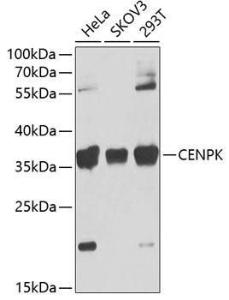 Anti-FKSG14/p33 Rabbit Polyclonal Antibody