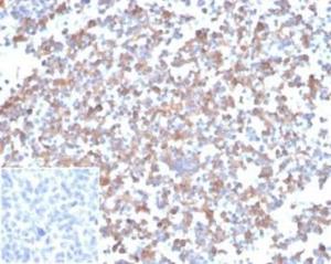 Immunohistochemical analysis of formalin-fixed, paraffin-embedded human tonsil tissue using Anti-SPARC Antibody [OSTN/3933]. Inset: PBS instead of the primary antibody. Secondary antibody negative control