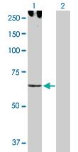 Anti-CDH6 Rabbit Polyclonal Antibody