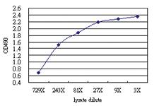 Anti-OLIG2 Antibody Pair