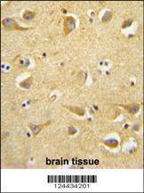 Anti-CLTC Rabbit Polyclonal Antibody (HRP (Horseradish Peroxidase))