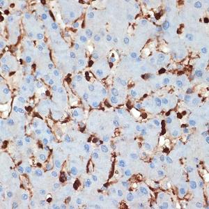 Immunohistochemistry analysis of paraffin-embedded human liver using Anti-S100 alpha 6/PRA Antibody [ARC2005] (A306836) at a dilution of 1:100 (40X lens). Perform microwave antigen retrieval with 10 mM Tris/EDTA buffer pH 9.0 before commencing with IHC staining protocol